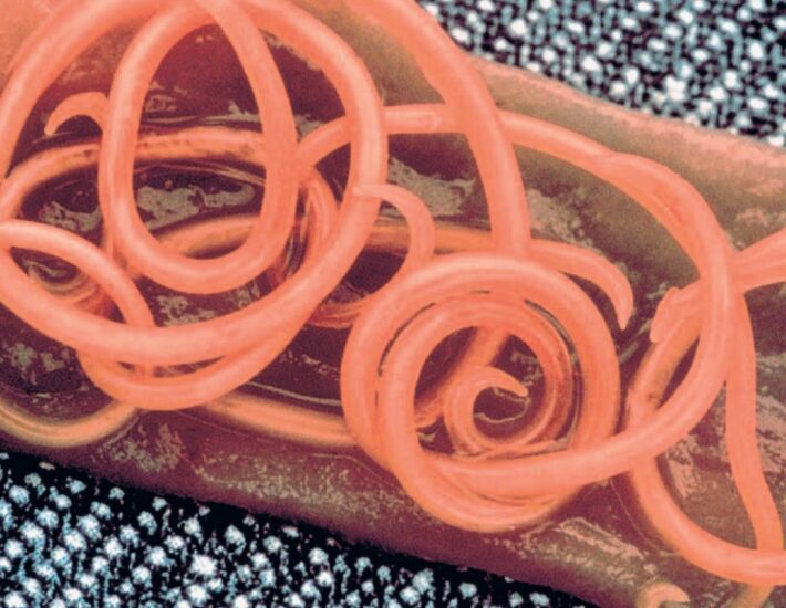 Bandwürmer des menschlichen Körpers