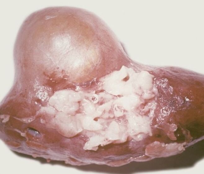 Was sind Parasiten