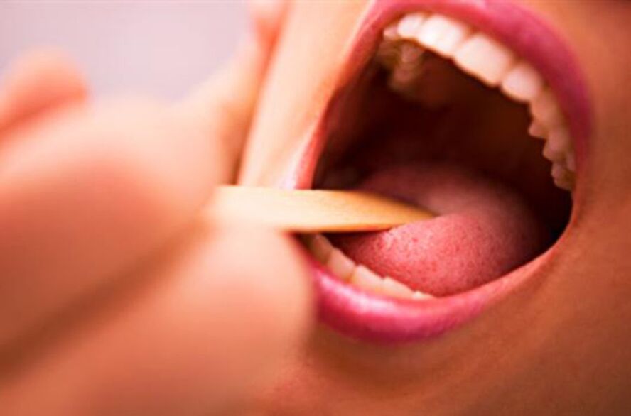 Arten von Parasiten im menschlichen Mund